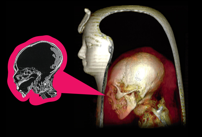 Digital illustration of a skeleton inside of a Pharoah tomb with a closer analysis of the skeleton